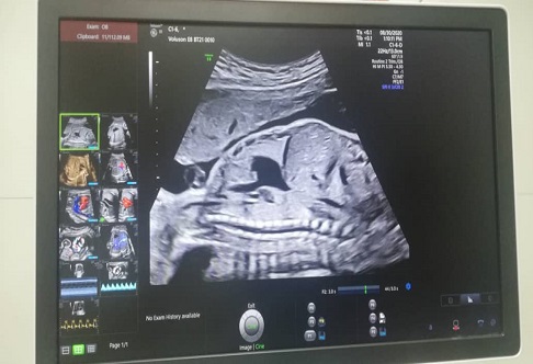 رادیولوژی 1